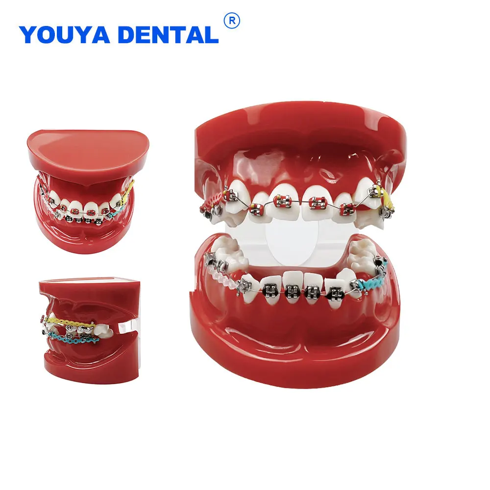 

Dental Teaching Model with With Braces Full Metal Brackets For Studying Typodont Orthodontic Models Dentistry Teaching Demo