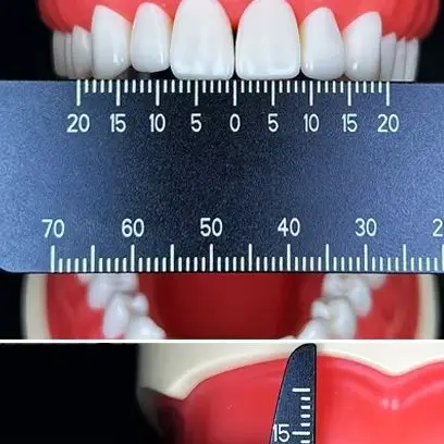 

Dental Precision Measuring Ruler Medical Tool for Photography and Span Measure Scale Endodontic Instruments Dentistry