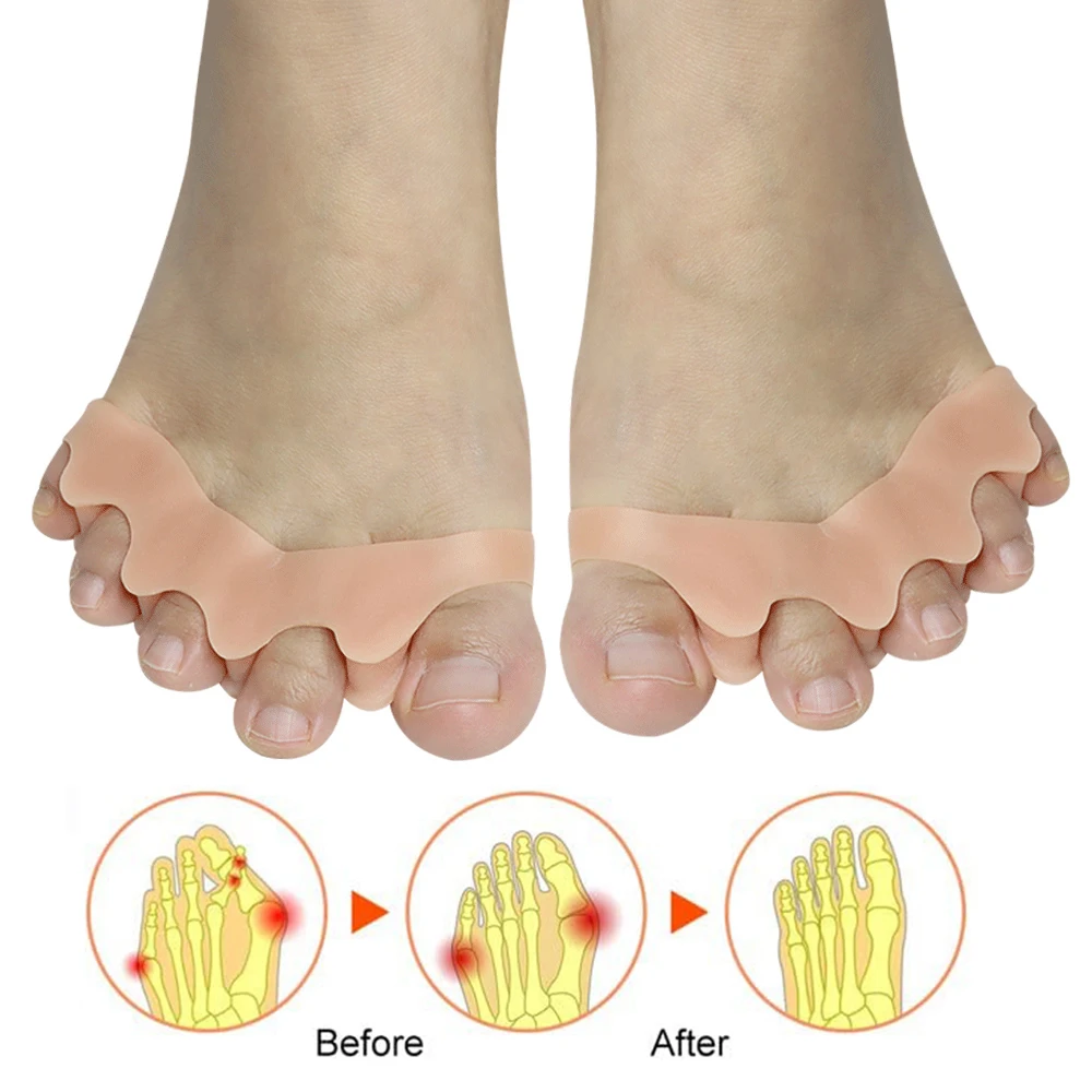 Pexmen 2/4/8Pcs Gel Toe Separator Toe Spacer for Men and Women Bunions Corrector Correct Restore Toes to Their Original Shape