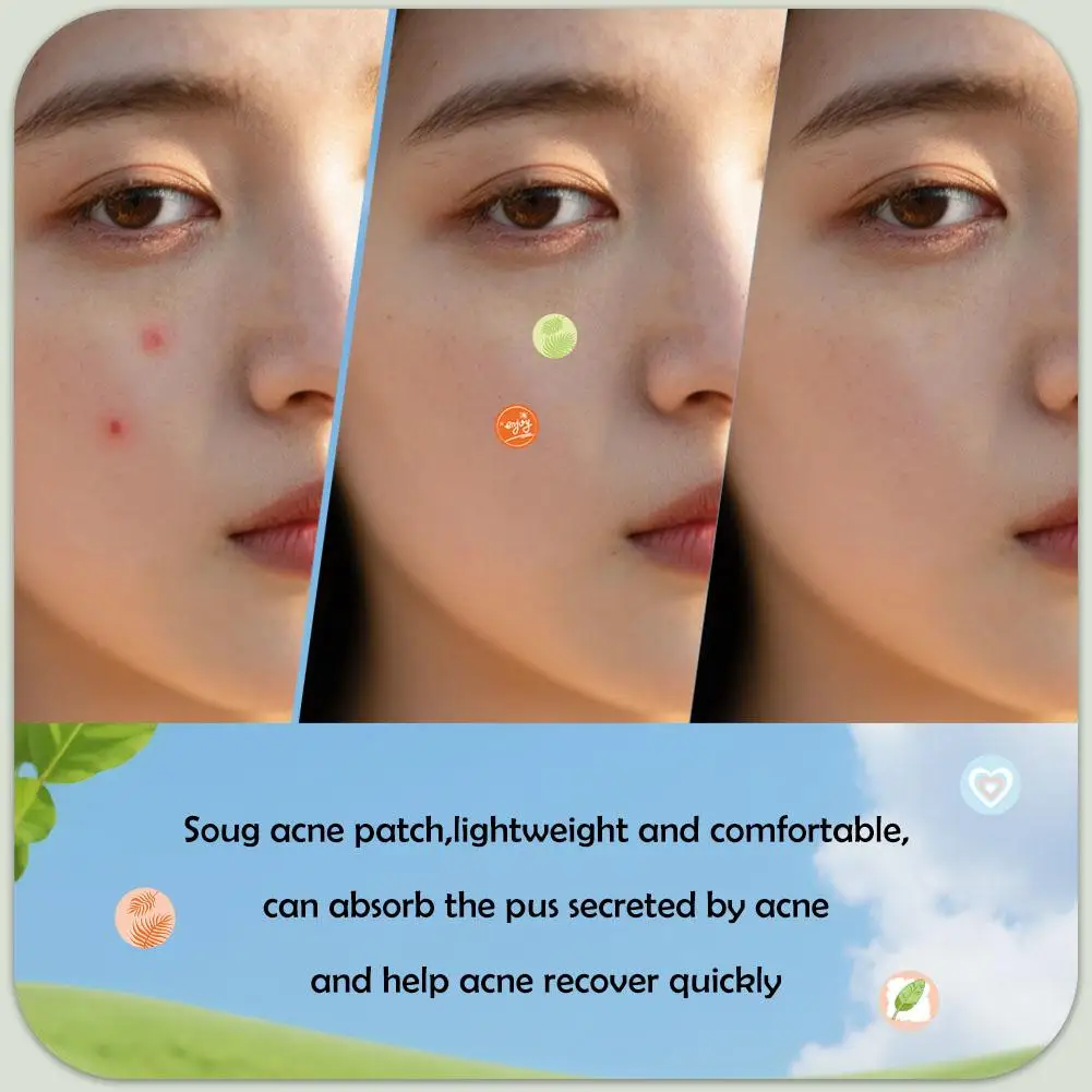 220 قطعة شكل قلب/نجمة حب الشباب بقع لطيف الكرتون حب الشباب التصحيح الجلد صالح رقيقة جدا الوجه حب الشباب بقع المخفي حب الشباب بقع