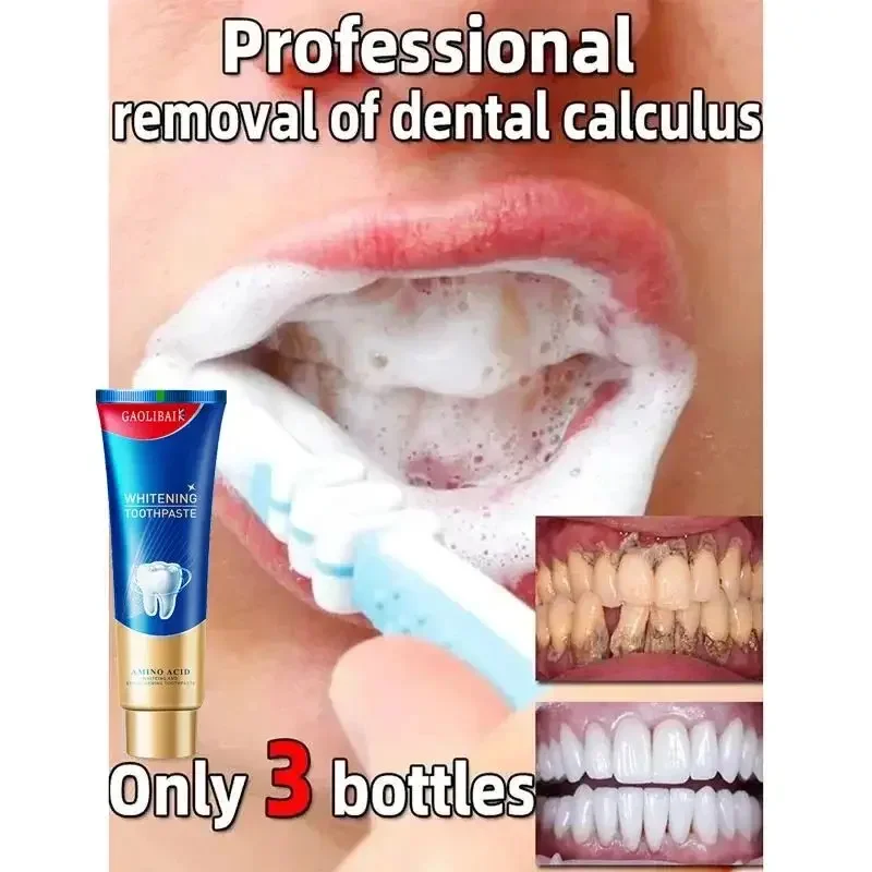 Dental Calculus Remover Whitening Removal Bad Breath Teeth Toothpaste Brightening Preventing Periodontitis Dental Cleansing Care