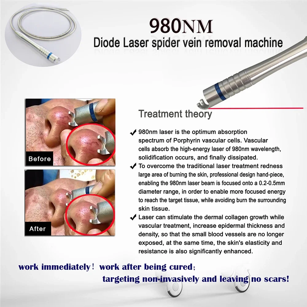 

CE Approved 980nm Diode Laser Onychomycosis Nail Fungus Treatment Device Vascular Vein Laser Diode 5 In 1 Spider Veins Removal