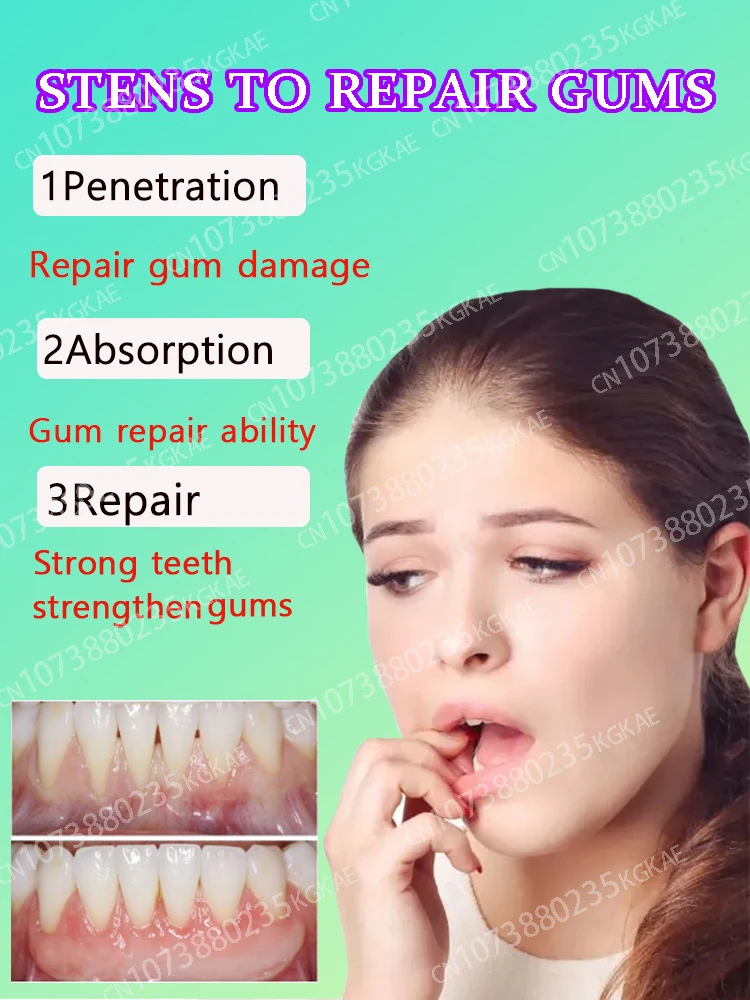 Quickly Repair Of Cavities Caries Drop Remove Teeth Stain Serum Relieve Gingival Swelling Gum Periodontal Hygiene Oral Care