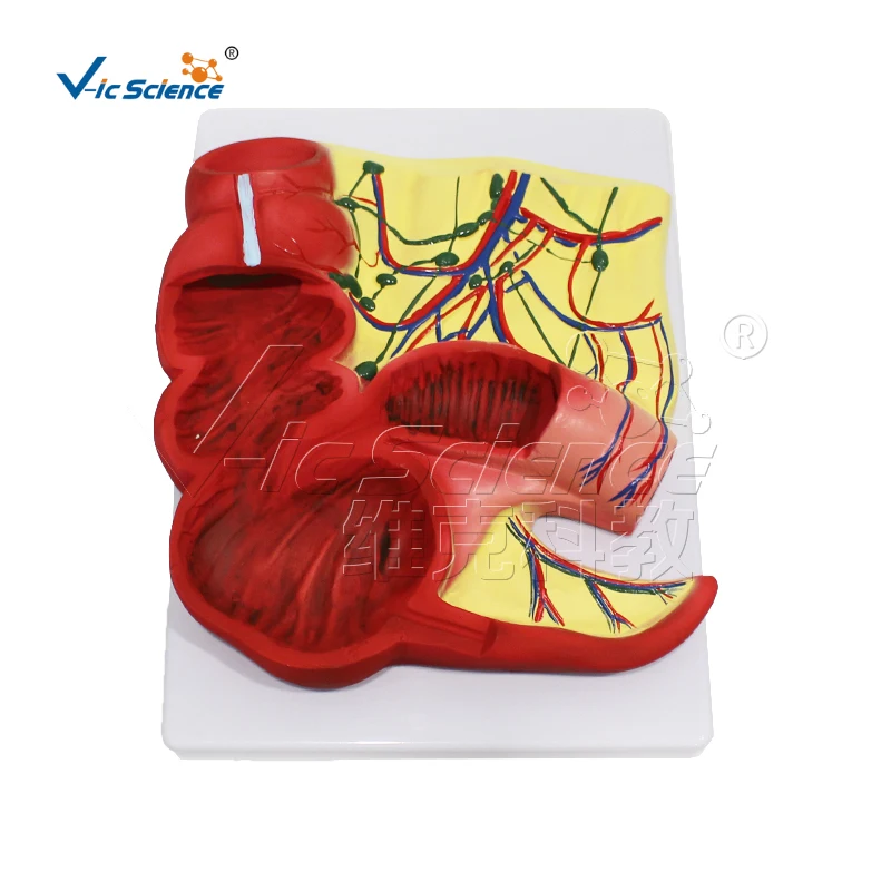 

Anatomical model of appendix and cecum Human pathology teaching model