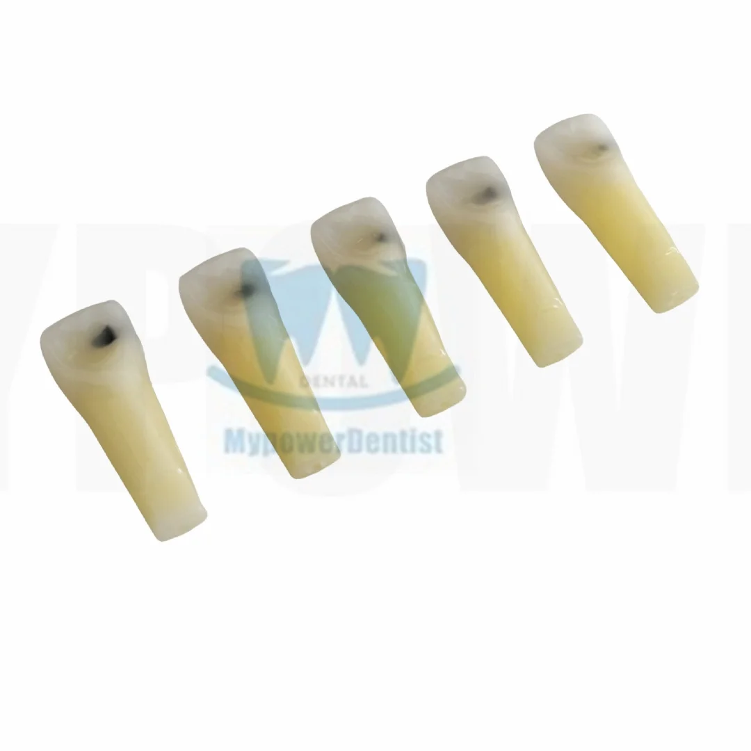 Dental Cavity Preparation Hole Practise Model Filling Template /Vitro Decay Caries Model/Composite Resin Filling Model