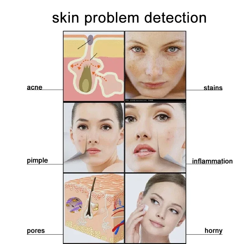 7 インチ頭皮検出器毛包油水分テスター 50X/200X ポータブル皮膚分析機スキンケアモニター充電式