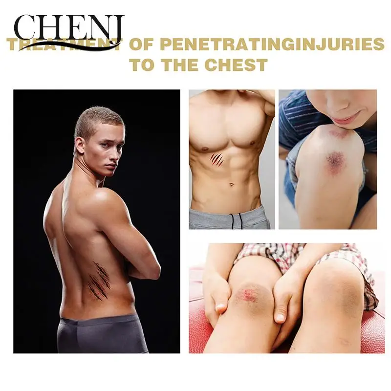 6Pcs Emergency Trauma Sticker Chest Seal Medical Chest Seal Vented First Aid Patch Wound Dressing Outdoor Safety Survival Tool