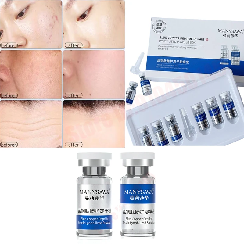 Korean Blue Copper Peptide Freeze Dry Powder Solution Age Reversing Skin Acne Pit Essence