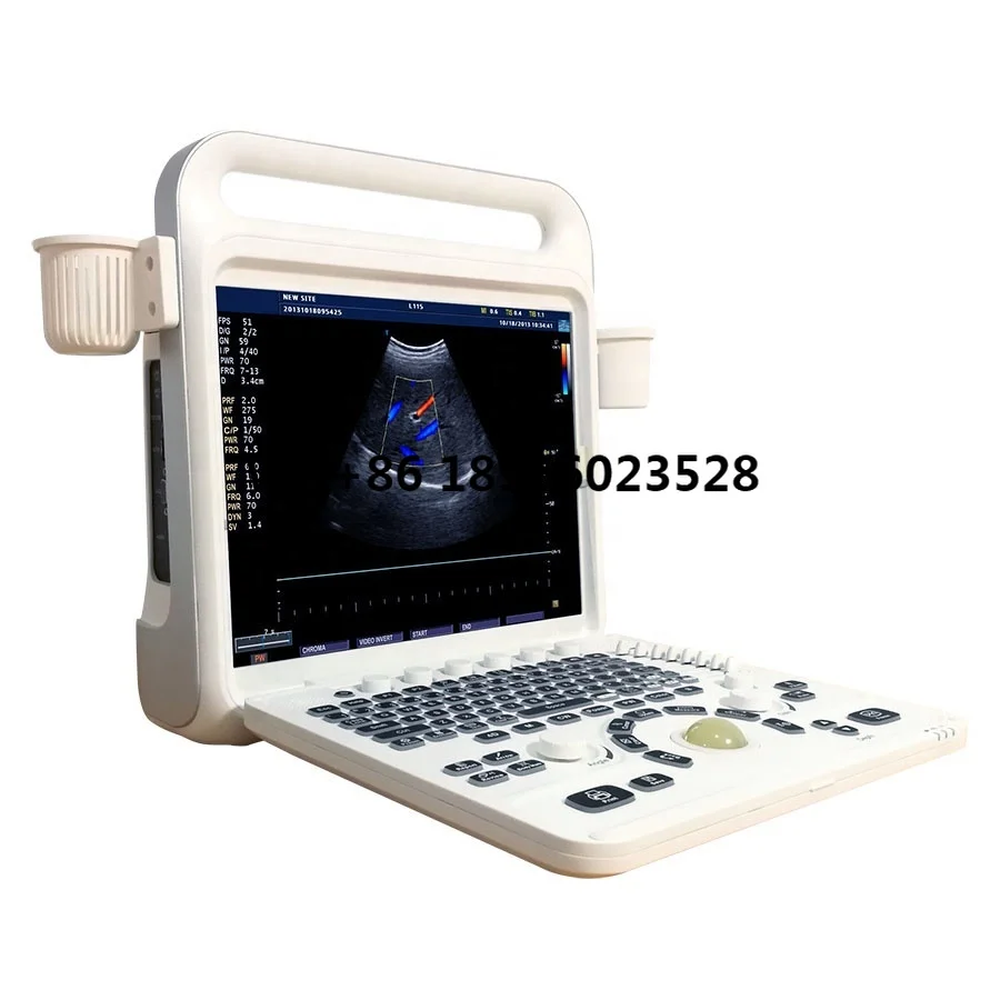 

Portable Tablet Ultrasound Machine Color Doppler 3d 4d Ultrasound Scanner