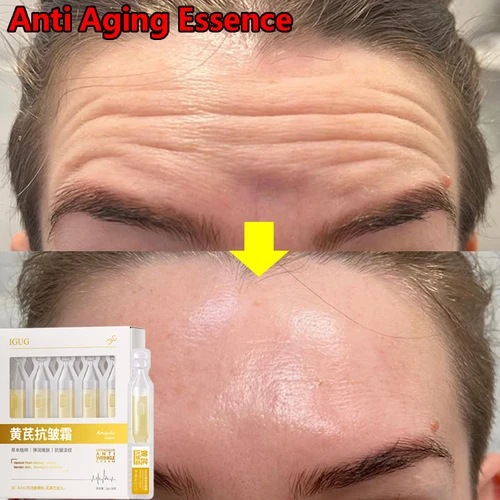 Imagen 2 del producto Esencia removedora instantánea de arrugas de astrágalo, suero facial de líneas finas que se desvanece, reafirmante antienvejecimiento, blanqueamiento, cuidado de la piel coreano