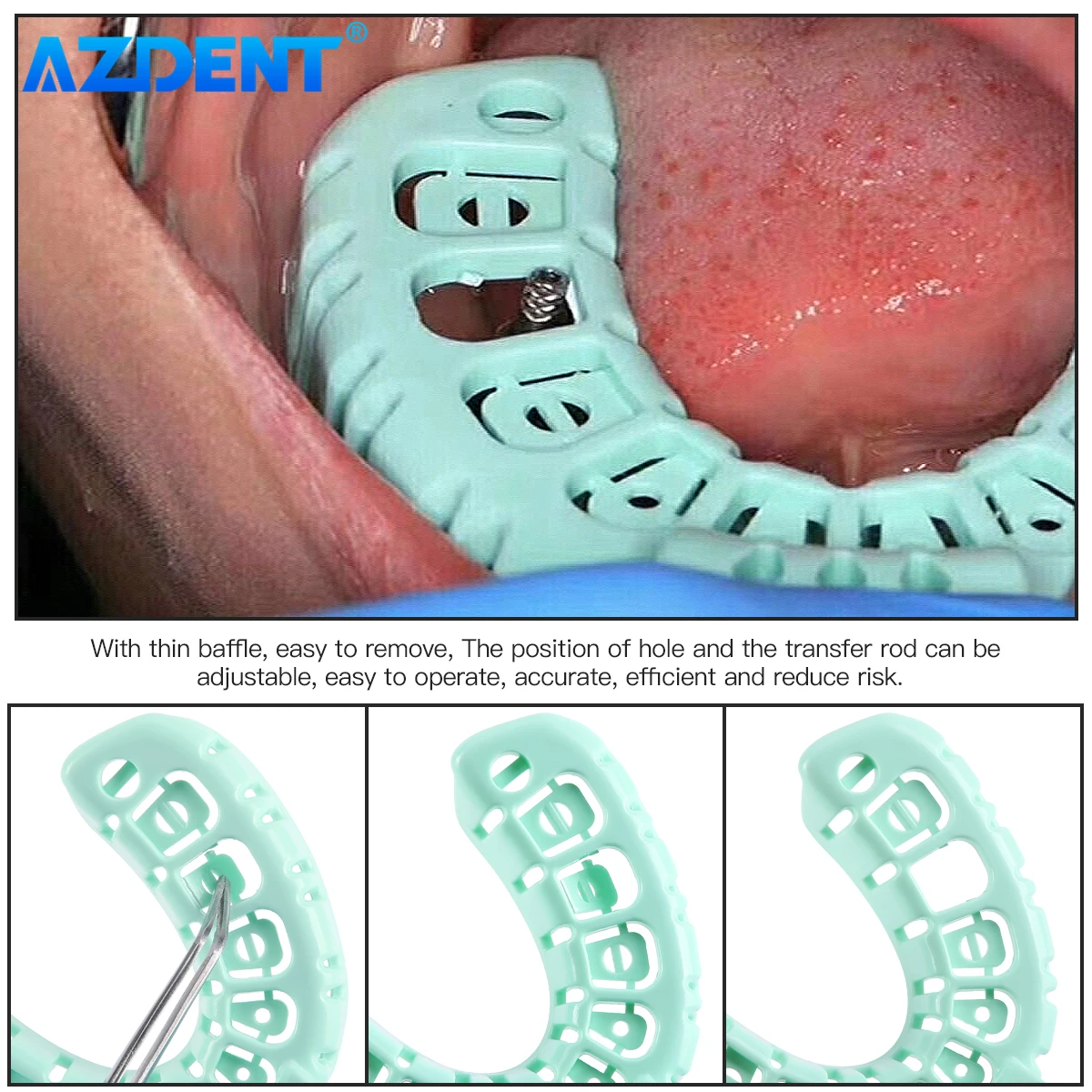 3 Pairs Dental Implant Tray AZDENT Green Full Mouth Impression Trays Removable Partial Mold Large Medium Small Dentistry Tools