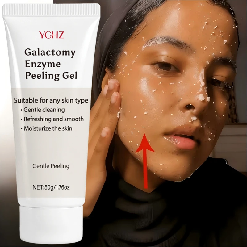 Blackhead Skin Cleansing Gel - Deeply Exfoliates Pores, Removes Blackheads and Whiteheads, Suitable for All Light Beige Skin Types, Especially for Oily Light Beige Skin, Deeply Hydrating