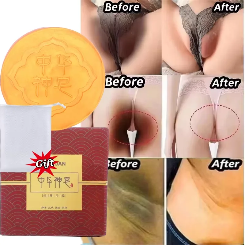 Body Whitening Soap Deep Cleaning Armpit Leg Knees Underarm Bleaching Chicken Skin Removal Soap Brighten Smooth Fair Skin Care