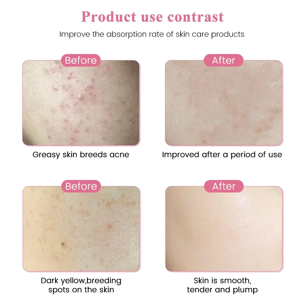 Derma Pen eléctrico Dispositivo de máquina de cuidado de la piel inalámbrico Microblading profesional MicroNeedles Gun Derma Mesoterapia 6pcs