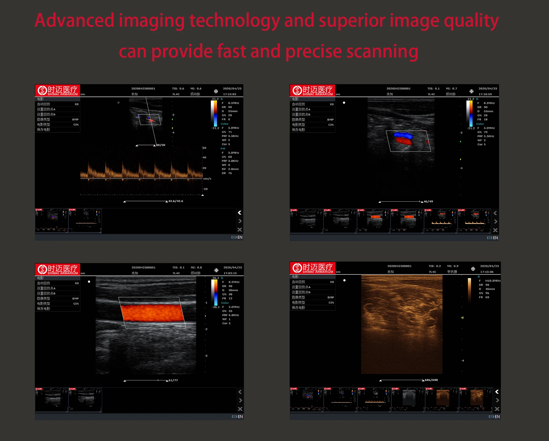 Новейшее ультразвуковое оборудование SMA M60 Ultra Sound, портативная ультразвуковая машина