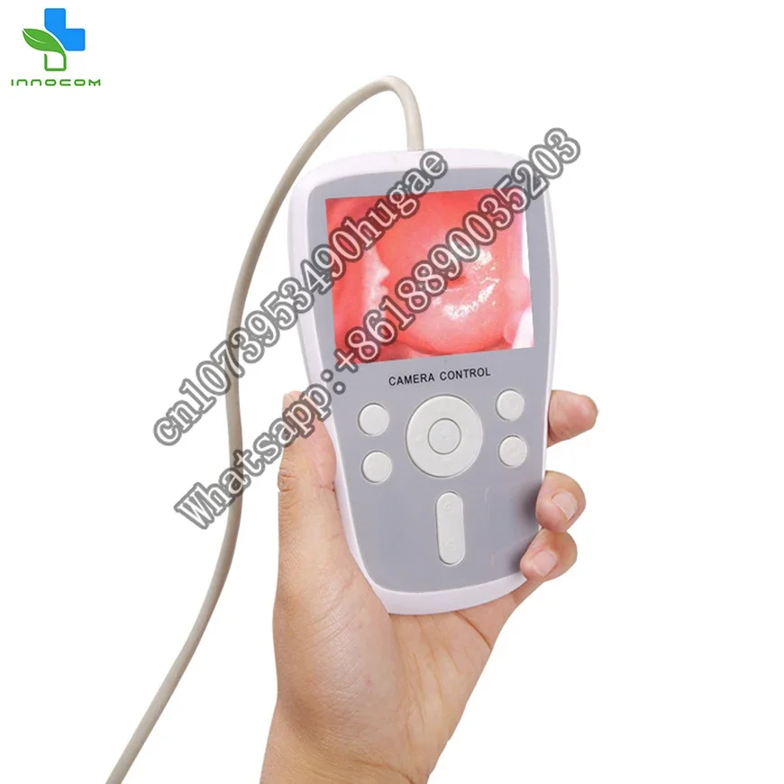 Medical portable handheld gynecology colposcopy system digital women gynecology electronic video