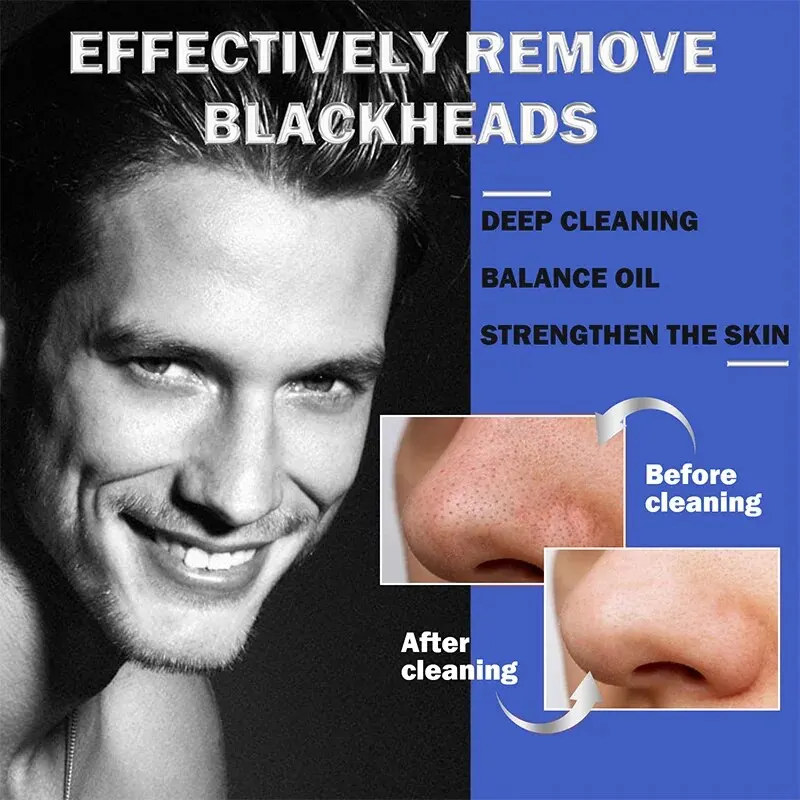 Men'S Blackheads Tighten Pores, Pimples, Acne, Blackheads Clean, Shrink And Tear Nasal Strips Easily Remove Blackheads
