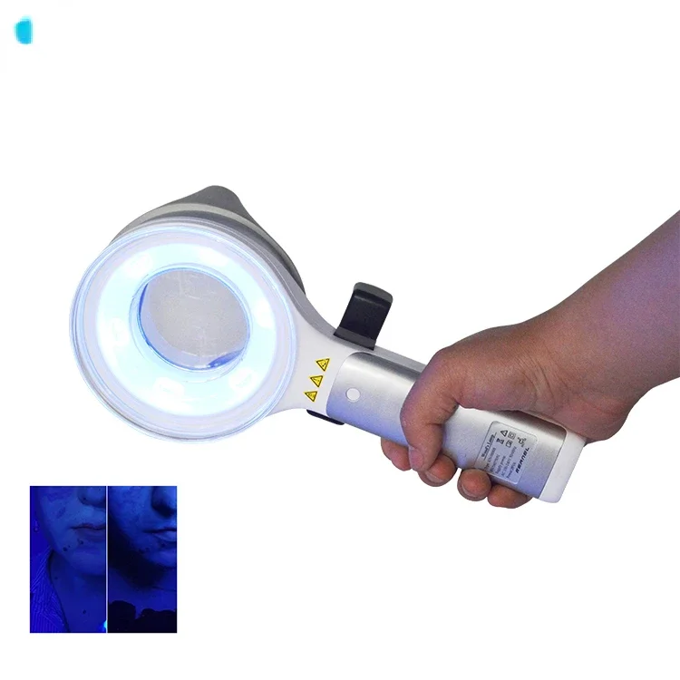 KN-9000B Medical CE approved Combined Light UVA and LED woods lamp examination skin analyzer for skin disease test