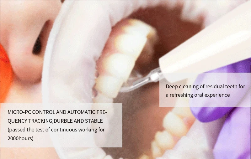 VVDental Ultraschall-Scaler passend für SATELEC/DTE Mundhygiene-Zahnaufhellungs- und Reinigungswerkzeuge mit Handstück und Aufsätzen Zahnmedizin-Maschine – Detail 7