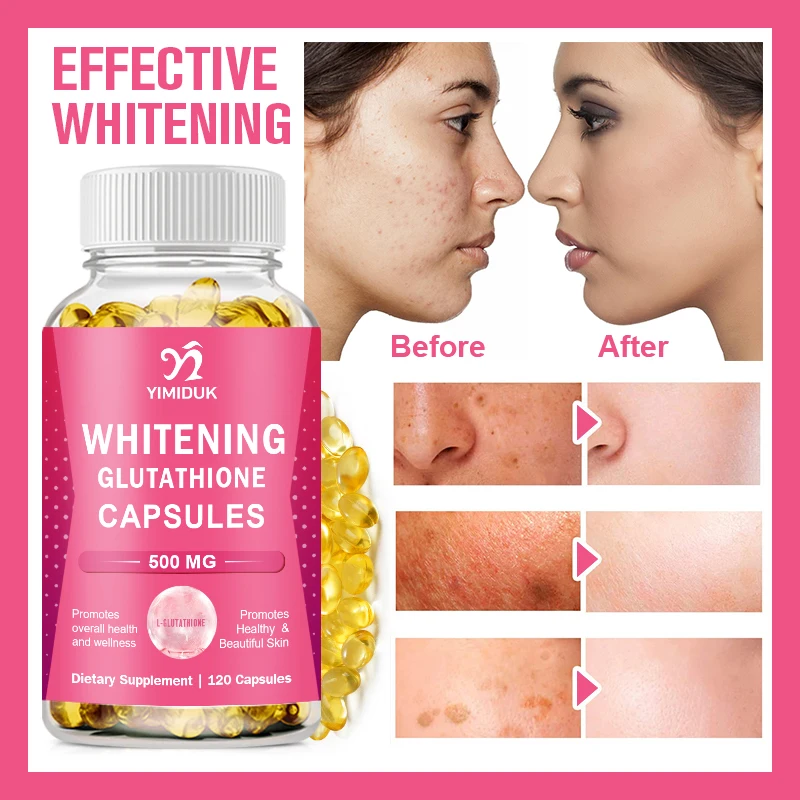 Glutathione Whitening Capsules - Dark Spots & Acne Scar Remover Vegan Skin Bleaching with Anti-aging, Brightening & Even Skin