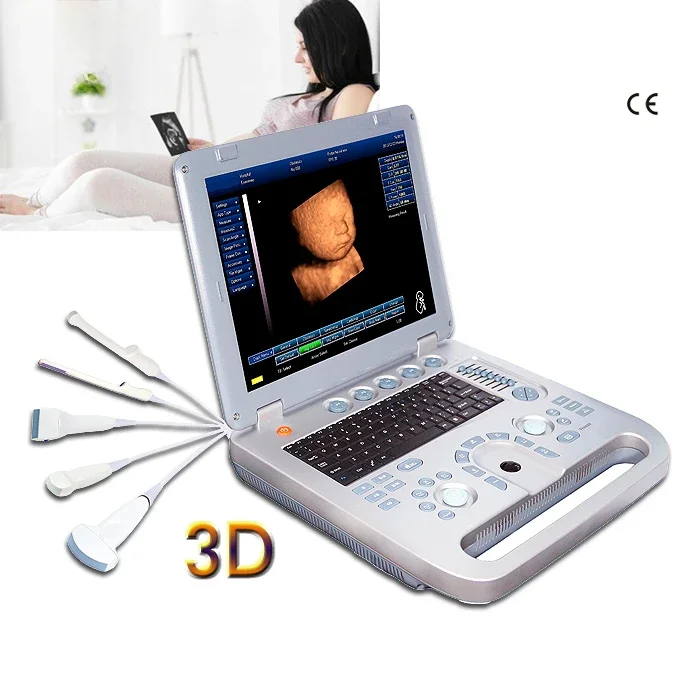 portable 3d ultrasound machine medical scan digital pseudo color usg 4d optional ecography