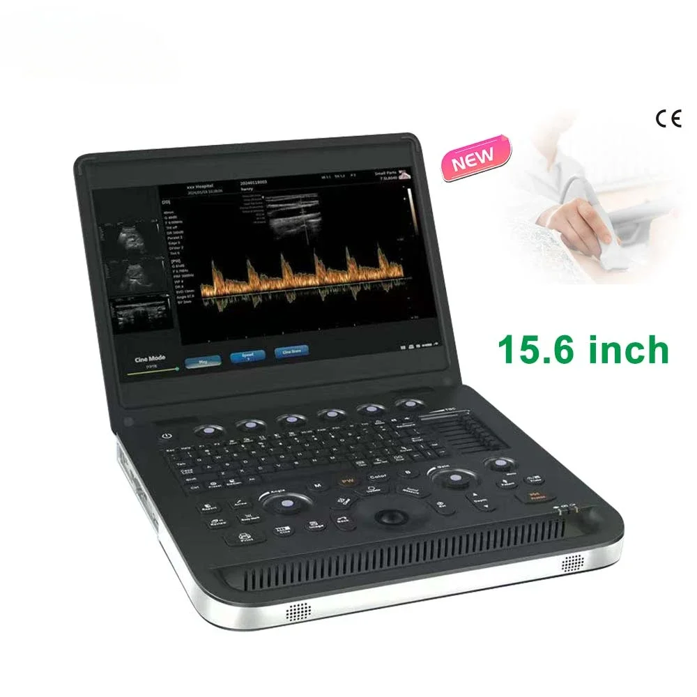 

15.6-Inch Screen Cheap 2D PW Notebook Doppler Ultrasound Diagnostic System Medical Scanning Device SUN-800C