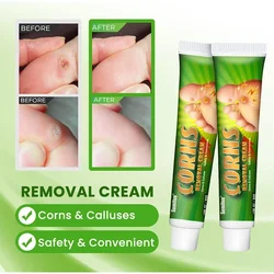 Foot Corn Remover Cream Chicken Eye Skin Infection Treatment Ointment Feet Dead Skin Calluses Removal Tool Health Care 발톱무좀