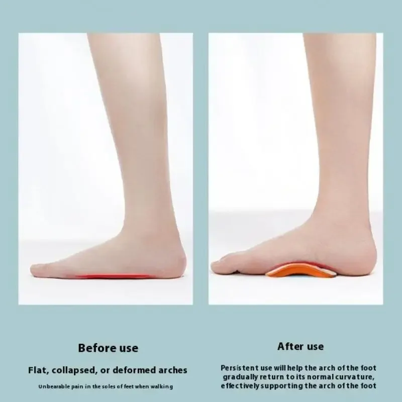 남녀 공용 발가락 외반/내반 교정 스포츠 깔창, 신발 안창, EVA 평발 아치 서포트, 정형외과용 깔창 1쌍