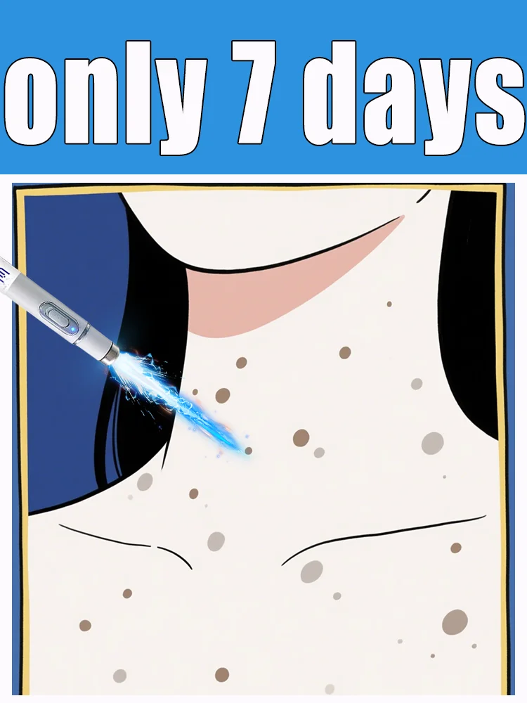 

Generation-2 laser says goodbye to all warts in 7 days