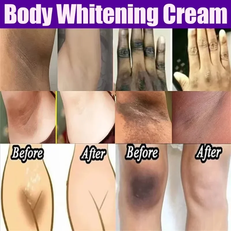 Body Whitening Cream Dark Skin Armpit Lightening Intimate Areas Underarm Bleaching Private Parts Whiten Cream Body Lotion Beauty - Image 4