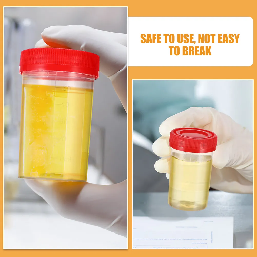 

100 шт. градуированных стаканчиков для образцов мочи с герметичными крышками для сбора и транспортировки лабораторных образцов, легко переносимые, медицинские