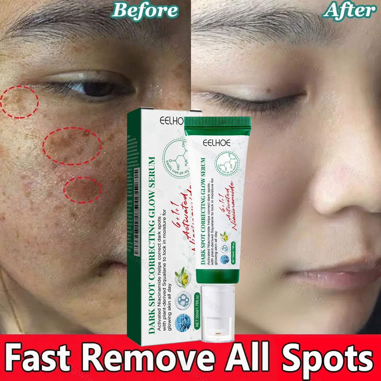 

Nicotinamide Intense Anti Dark Spots Serum Cream Whitening Fade Freckles Melasma Remover Treatment Brightening Skin Care 50g