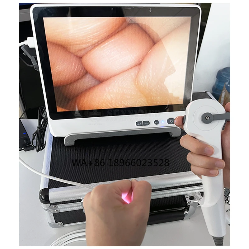 SY-P029-3 cystoscope disposable digital flexible ureteroscopy endoscope system with touch screen