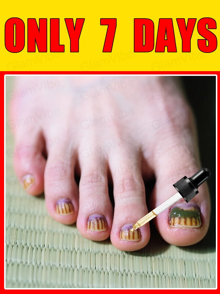 

2025 Toenail Fungus Patch Waterproof Nail Repair Patches Nail Ingrown Correction Sticker Discolored Damaged Nail Foot Care Tool