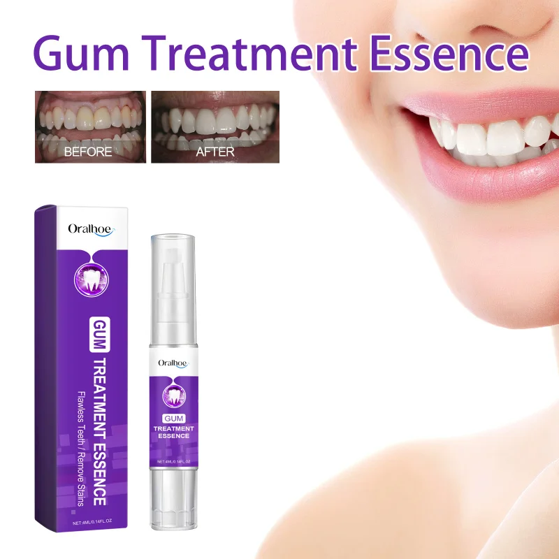 

Purple Teeth Whitening Pen - Oral Cleaning, Gum Protection, Teeth Whitening, Remove Yellow Stains, Brighten & Whiten Teeth