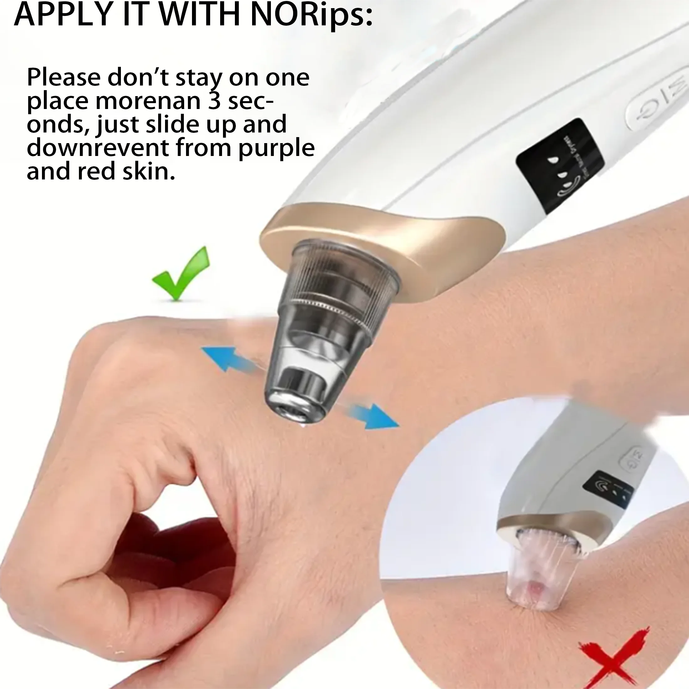 Aspirador de pó elétrico de poros, removedor de cravo recarregável USB, tratamento de acne com circulação de água, ferramenta de extração de cravo.