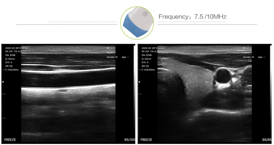 High End Veterinary Wireless Ultrasound For Animals Liner Probe Ultrasound Mini Wifi 5G Color Doppler Ultrasound