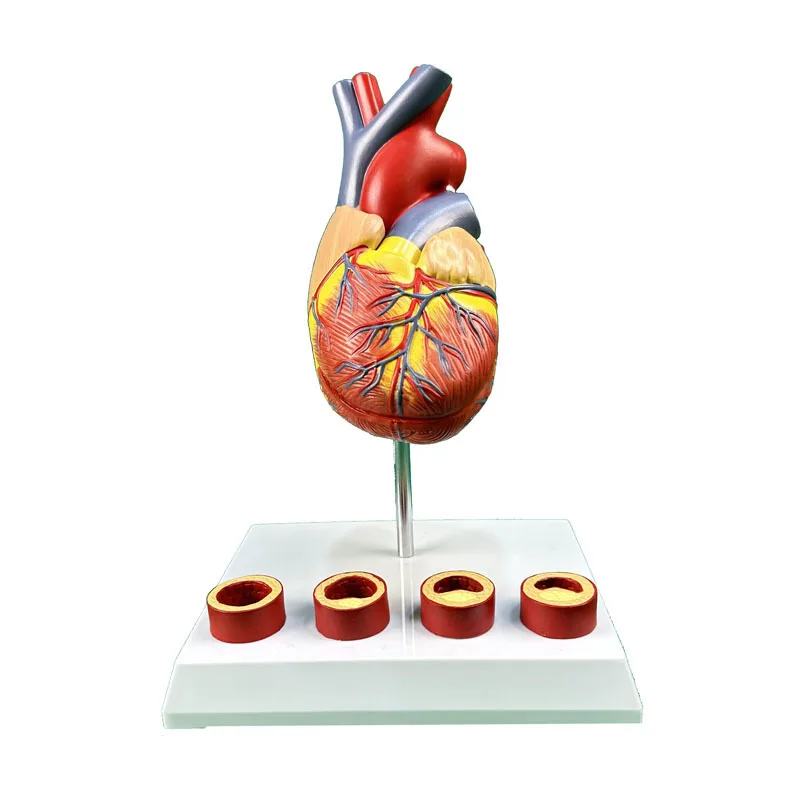 Large natural heart zone thrombosis medical teaching and training model