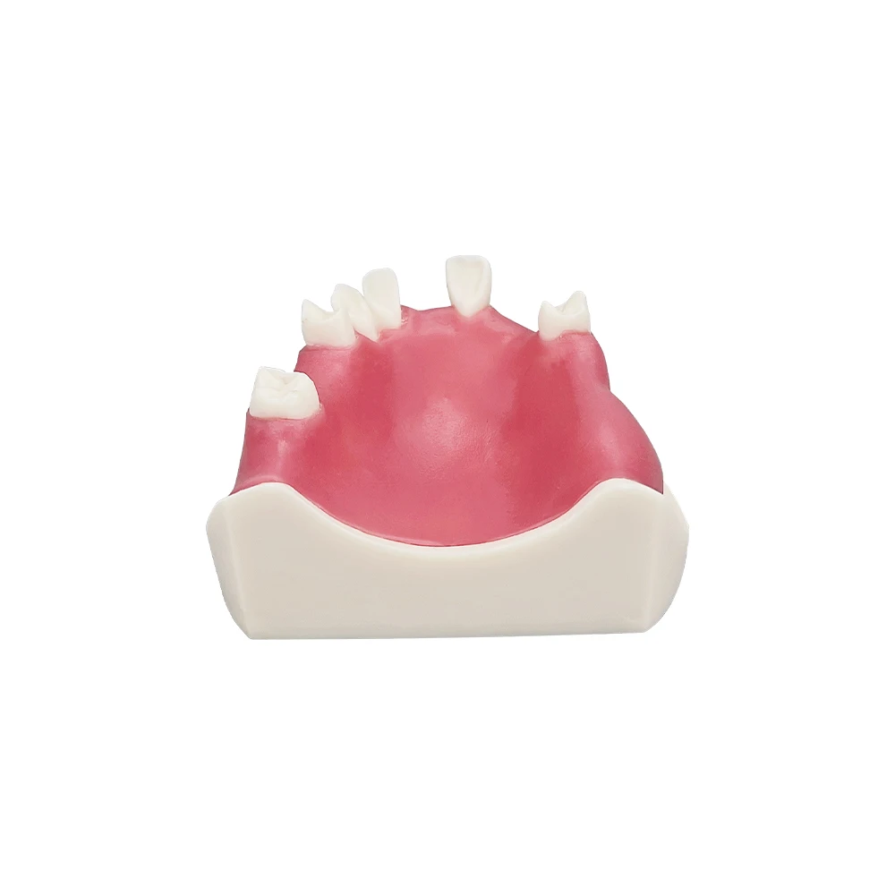Dental Implant Training Model Soft Gum Teeth Practice Typodont With Missing Teeth Dentistry Studying Teaching Demonstration Tool