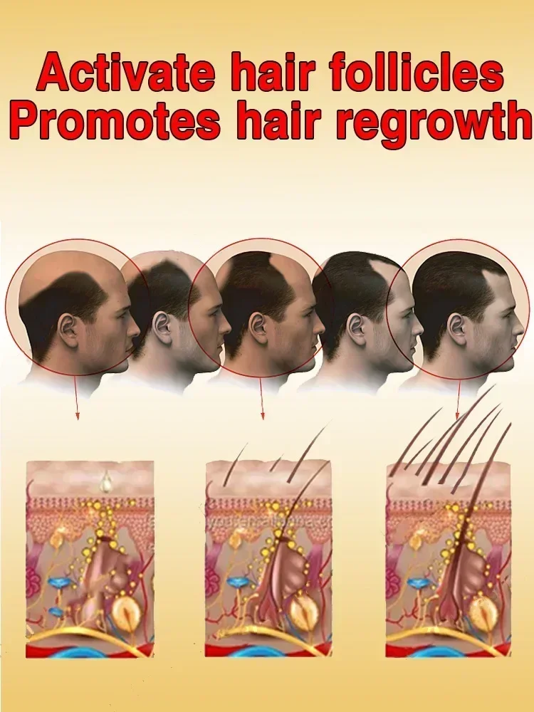 Hair Growth Oil For Men Biotin Fast Treatment Baldness Serum