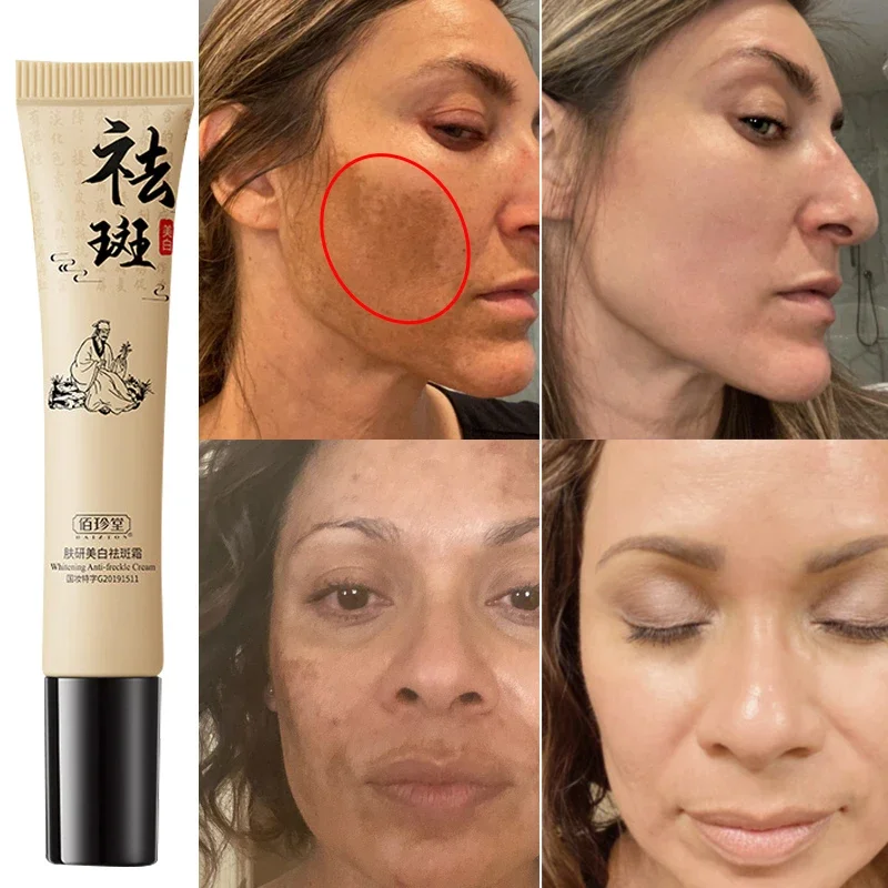 

freckle removing cream remove chloasma black spots whitening melanin removing cream moisturize whiten skin care