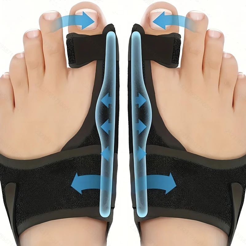 

Bunion Corrector Splint Straightener Support Toes Foot Thumb Orthosis Hallux Valgus Corrector Orthopedic Tools Left and Right
