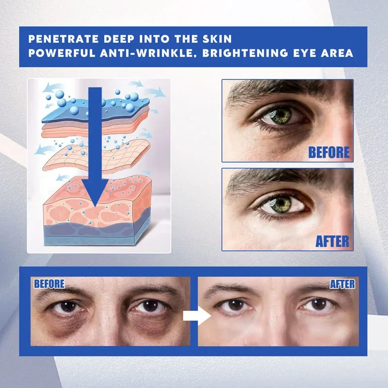 Crème dissolvant de sacs pour les yeux au rétinol pour hommes, Anti-cernes, Anti-poches, estompe les ridules, Lifting, raffermissant, hydratant, réparation, soins pour la peau