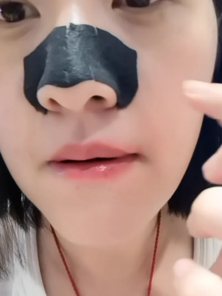 Blackhead Nose Strips Deep Cleansing 10-20Pcs Nasal Spots Facial Dot Stickers Nose Masks Shill for Acnes & Black Head - Dropship