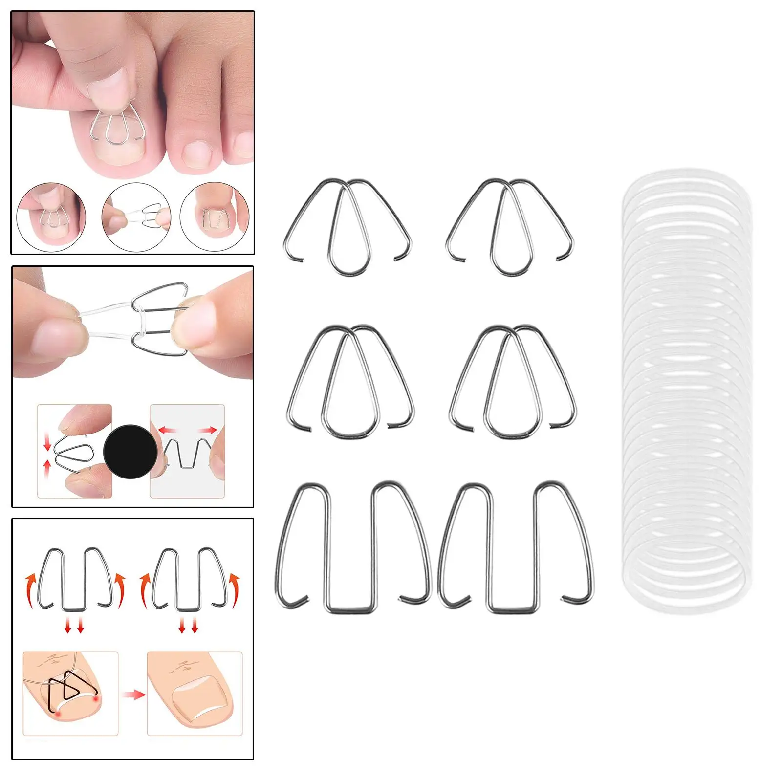 6Pcs Ingrown Toe Nail Correction Wire with 30 Rubber Rings Relieve Discomfort, Toenail Fixer Nail Correction Hook, Easy to Use