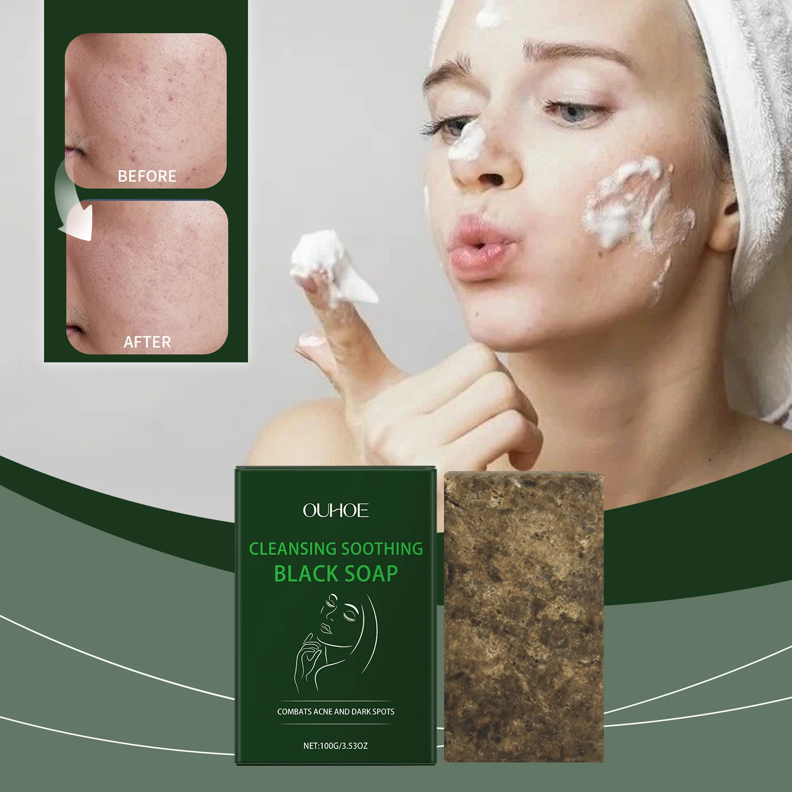 Savon noir – Barre nettoyante et apaisante pour le visage et le corps, combat l'acné et les taches foncées, savon exfoliant naturel pour une peau claire