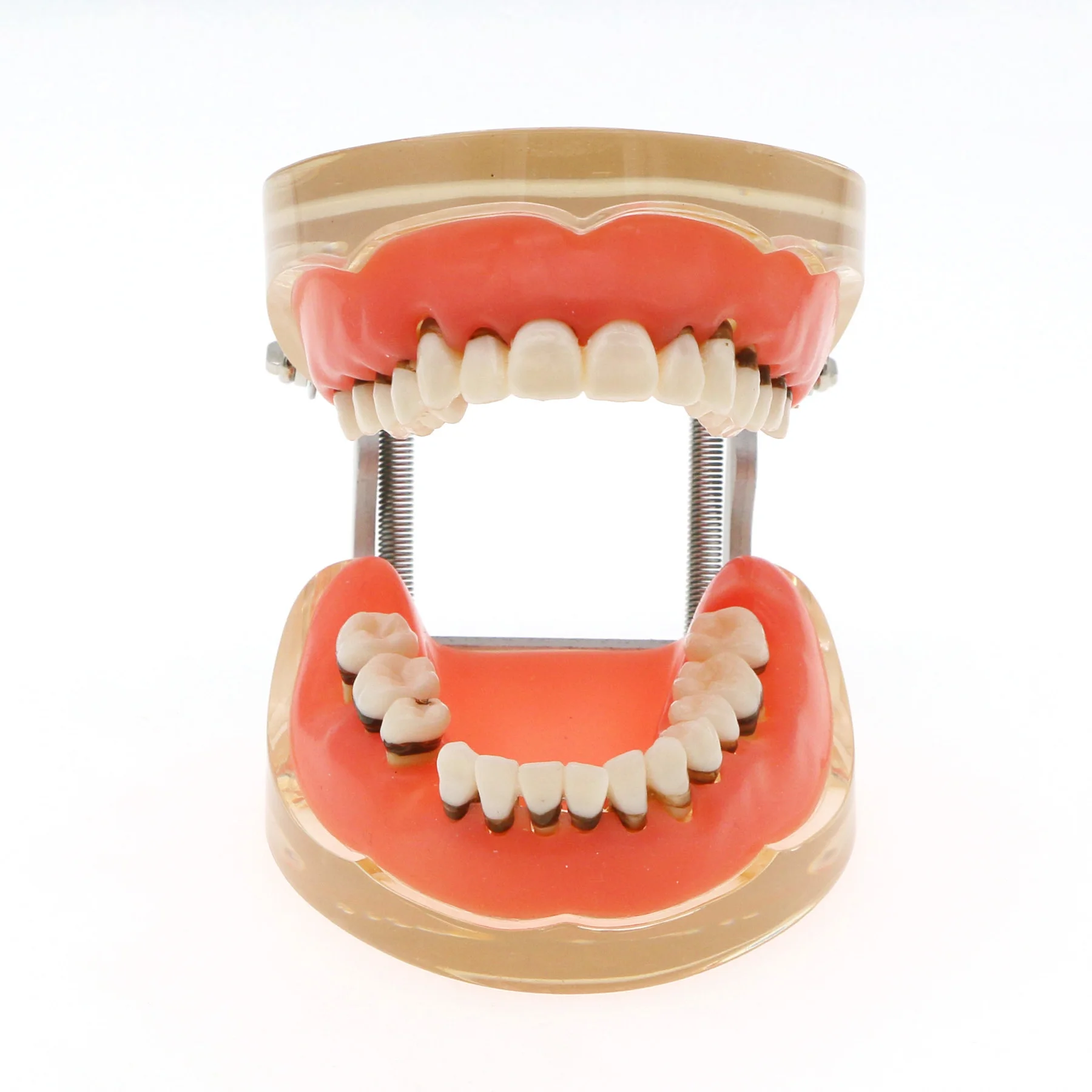 Dental Teeth Model Adult Pathological Periodontal Disease Study Teach Teeth M4017