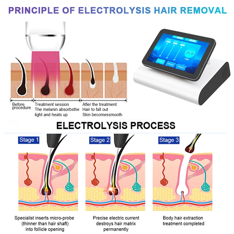 27.12MHz Blend Electrolysis Hair Removal Device Permanent Hair Removal Machine for Men Women Body Bikini Home Salon