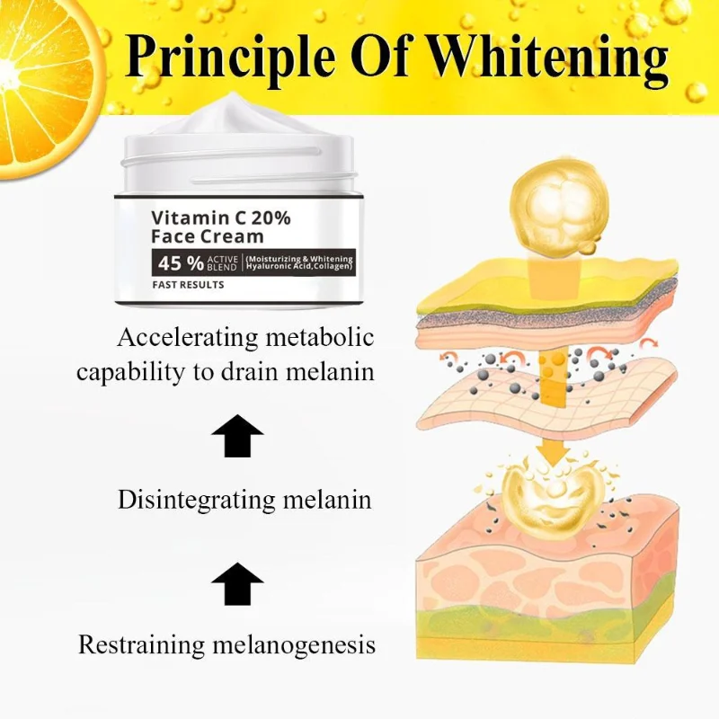 Effective Whitening Freckle Cream Remove Melasma Acne Spot Pigment Melanin Dark Spots Pigmentation Moisturizer Skin Care