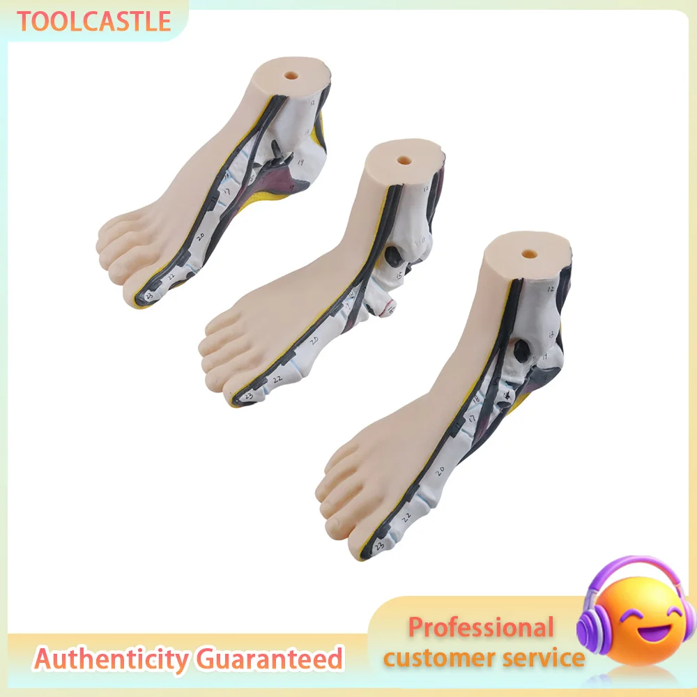 Healthy vs Deformed Foot Model Flat Foot Normal Arch Pes Cavus Pathology Display for Medical Teaching